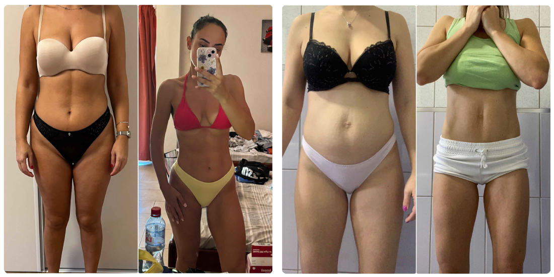 dijastaza nikola orozovic